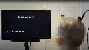 AI system restores speech for paralyzed patients using own voice